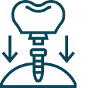 dental-implant